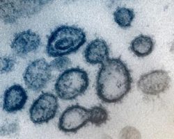 Michigan health officials report 249 new cases of coronavirus, state total at 1,035