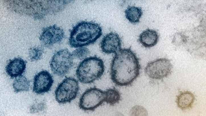 Michigan health officials report 249 new cases of coronavirus, state total at 1,035